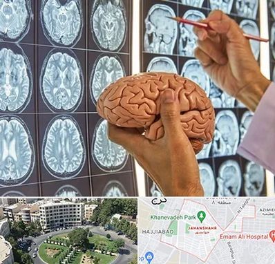 جراح مغز و اعصاب در جهانشهر کرج 
