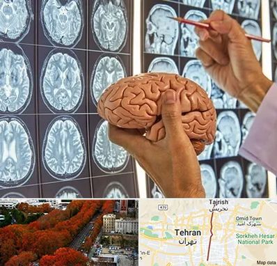 جراح مغز و اعصاب در ولیعصر 