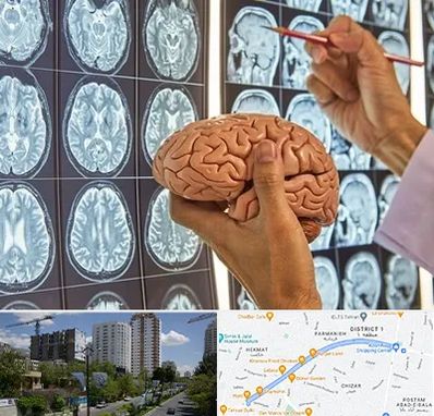 جراح مغز و اعصاب در اندرزگو 