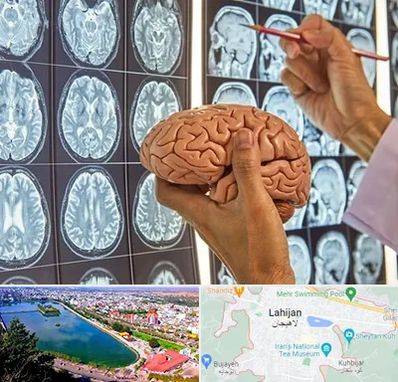 جراح مغز و اعصاب در لاهیجان