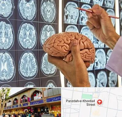جراح مغز و اعصاب در 15 خرداد