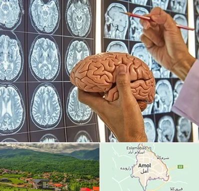 جراح مغز و اعصاب در آمل