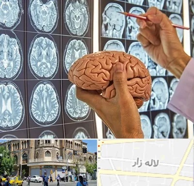 جراح مغز و اعصاب در لاله زار