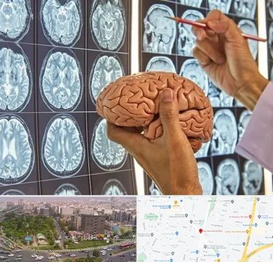 جراح مغز و اعصاب در آیت الله کاشانی 