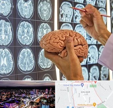 جراح مغز و اعصاب در گلسار رشت 