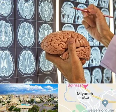 جراح مغز و اعصاب در میانه