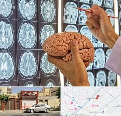 جراح مغز و اعصاب در باجک قم