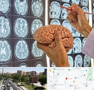 جراح مغز و اعصاب در شهرک آزمایش 