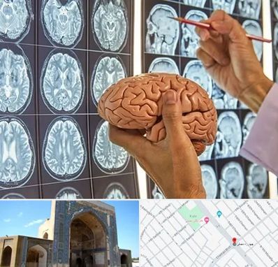 جراح مغز و اعصاب در مصلی مشهد