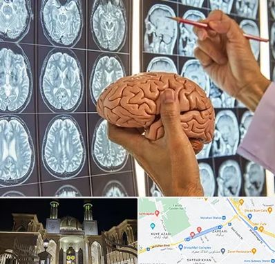 جراح مغز و اعصاب در زرگری شیراز 