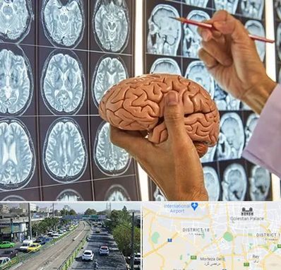 جراح مغز و اعصاب در جنوب تهران 