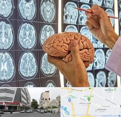 جراح مغز و اعصاب در بلوار فردوس 