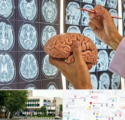 جراح مغز و اعصاب در طالقانی 