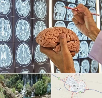 جراح مغز و اعصاب در شیروان