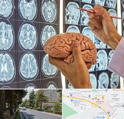 جراح مغز و اعصاب در مهرویلا کرج 