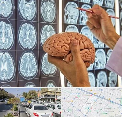 جراح مغز و اعصاب در مفتح مشهد 