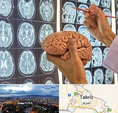 جراح مغز و اعصاب در تبریز