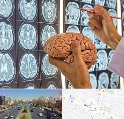 جراح مغز و اعصاب در بلوار معلم مشهد 