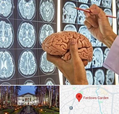 جراح مغز و اعصاب در باغ فردوس
