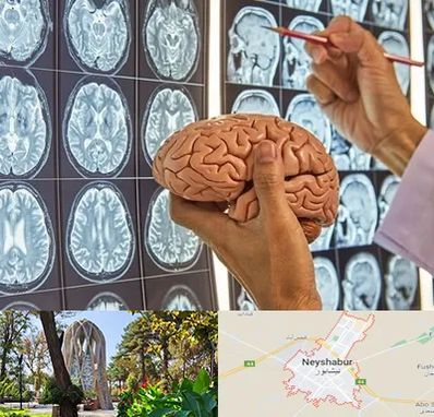 جراح مغز و اعصاب در نیشابور