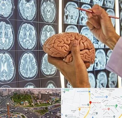 جراح مغز و اعصاب در سبلان 