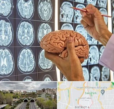 جراح مغز و اعصاب در یوسف آباد 