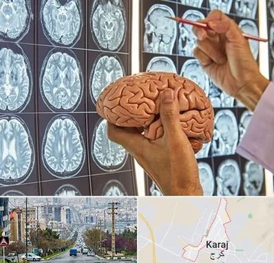 جراح مغز و اعصاب در گوهردشت کرج 