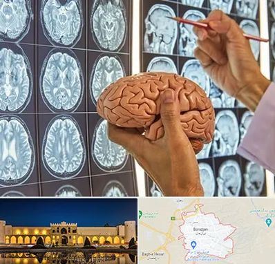 جراح مغز و اعصاب در برازجان