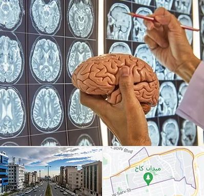 جراح مغز و اعصاب در سعادت آباد 