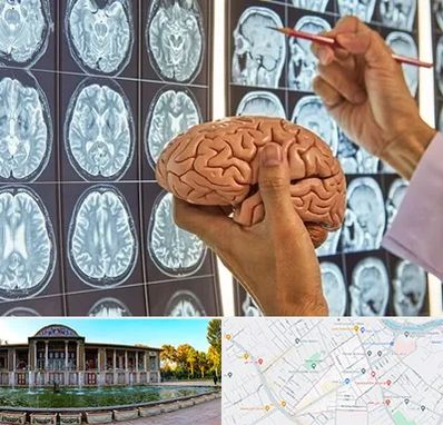 جراح مغز و اعصاب در عفیف آباد شیراز 