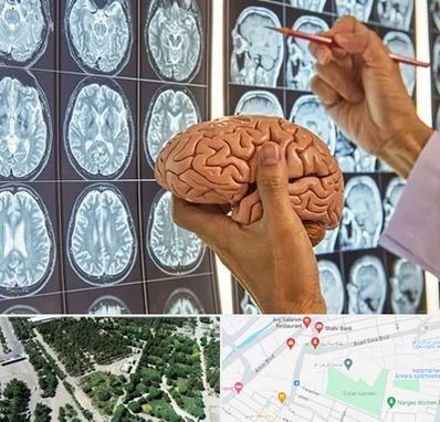 جراح مغز و اعصاب در سالاریه قم