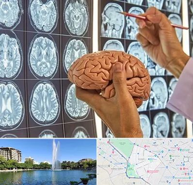 جراح مغز و اعصاب در کوهسنگی مشهد 