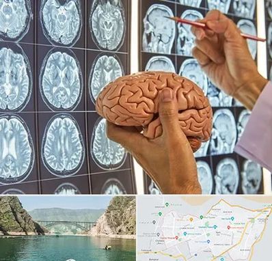 جراح مغز و اعصاب در ایلام