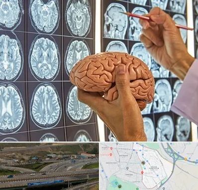 جراح مغز و اعصاب در یاغچیان تبریز