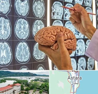 جراح مغز و اعصاب در آستارا