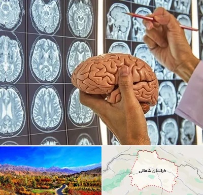 جراح مغز و اعصاب در خراسان شمالی