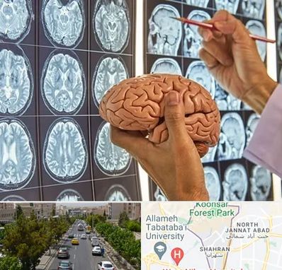 جراح مغز و اعصاب در شهران 