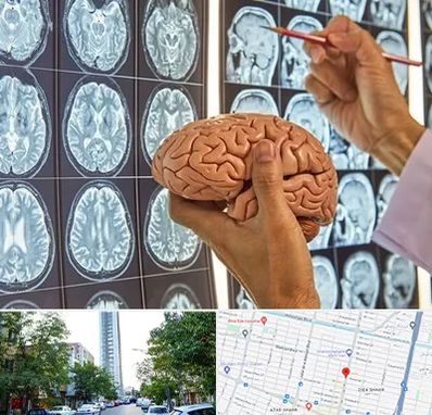 جراح مغز و اعصاب در امامت مشهد 