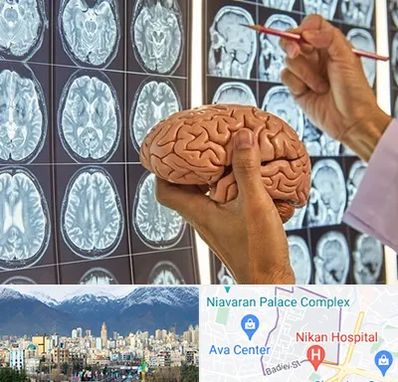 جراح مغز و اعصاب در آجودانیه 