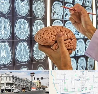 جراح مغز و اعصاب در 17شهریور