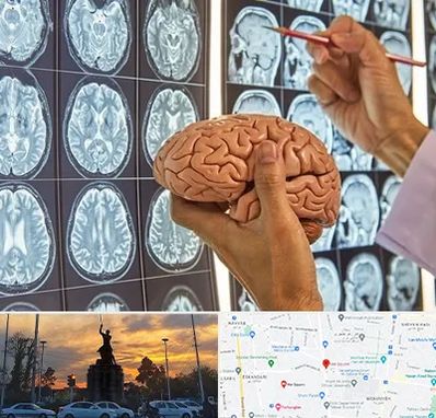 جراح مغز و اعصاب در میدان حر 