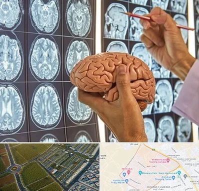 جراح مغز و اعصاب در الهیه مشهد 