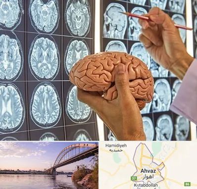 جراح مغز و اعصاب در اهواز