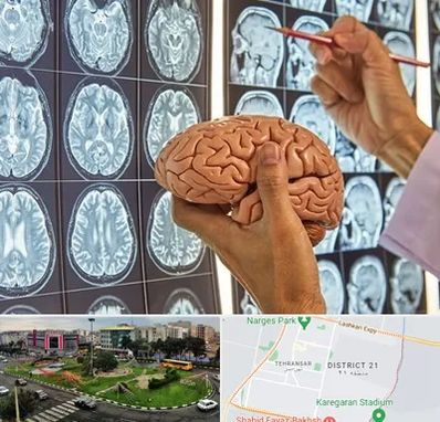 جراح مغز و اعصاب در تهرانسر 