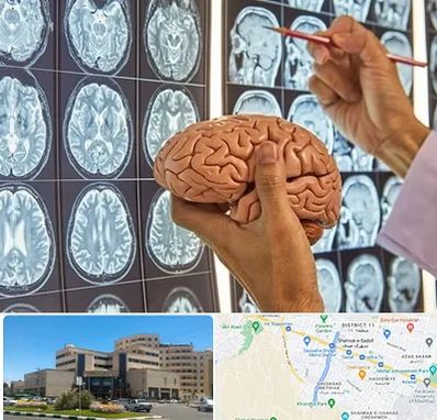 جراح مغز و اعصاب در صیاد شیرازی مشهد 