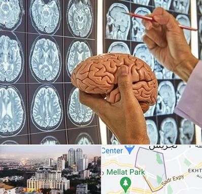 جراح مغز و اعصاب در الهیه 