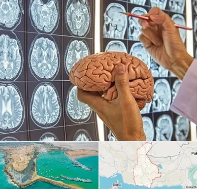جراح مغز و اعصاب در سیستان و بلوچستان
