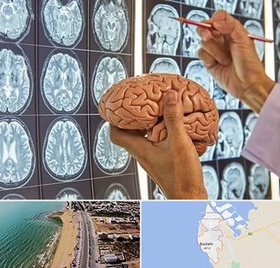 جراح مغز و اعصاب در بوشهر
