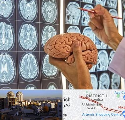 جراح مغز و اعصاب در فرمانیه 