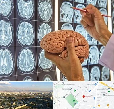 جراح مغز و اعصاب در هنگام 